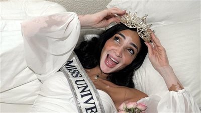 «رغم إصابتها بالبهاق».. لوجينا صلاح تشارك في مسابقة ملكة جمال الكون 2024