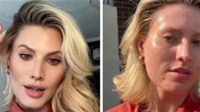 ضغوط الجمال الرقمي على الشباب.. معايير تجميلية وهمية وتأثيراتها النفسية