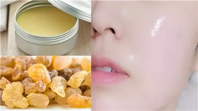 طرق استخدام لبان الذكر للبشرة.. فوائد جمالية وصحية