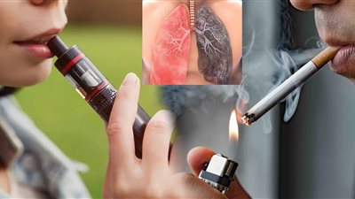 بريطانيا: 350 شابا مدخن جديد يوميا.. 300 ألف حالة سرطان سنويا