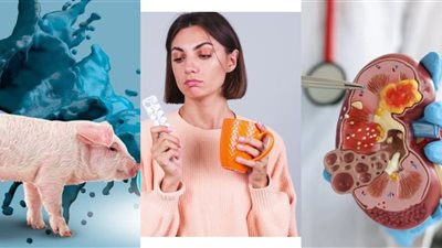 استخدام الخنازير لعلاج الكلى وحبوب منع الحمل بدون طبيب.. 7 اكتشافات طبية 2024