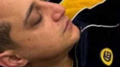 بعد رضا البحراوي .. احذر: علامات ضعف الدورة الدموية