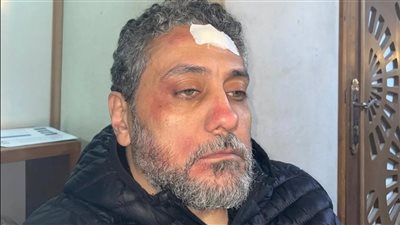 حادث الفنان تامر فرج أثناء تصوير مسلسل محمد هنيدي.. زوجته تكشف التفاصيل 