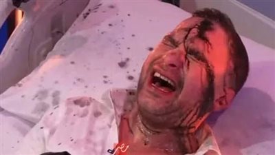 لون حذاء حسام حبيب .. تعرف على إجابة حلقة رامز إيلون مصر 