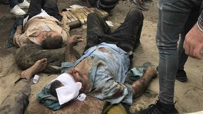 صور المصابين في حادث أتوبيس عمال بورسعيد اليوم