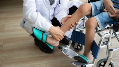 بعد جمع 106 ملايين جنيه لعلاج الطفل علي، كل ما تريد معرفته عن مرض ضمور العضلات