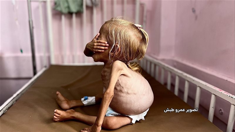 التجويع سلاح إسرائيل