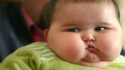 السمنة تسرق طفولتهم، أمراض تصيب أصحاب الوزن الزائد (تعرف عليها)