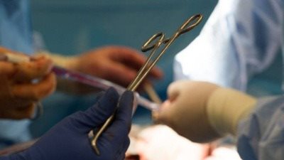 هل يوجد سرقة أعضاء بشرية في مصر؟ رد حاسم من الصحة