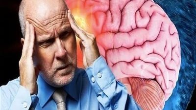 الصداع المتكرر، متى يكون مؤشر مباشر لـ ورم الدماغ؟