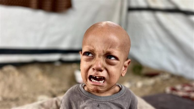 التجويع الإسرائيلي