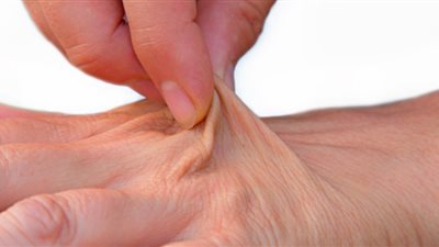 الأيام المصرية توضح: ما هو الجفاف ولماذا يزيد في موسم الصيف؟          