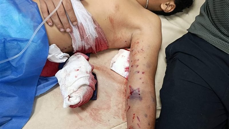 قصة طفل تعرض لطلق