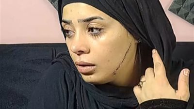 قطعت وشها بموس، تفاصيل القبض على سيدة شوهت وجه عروسة طليقها بـ 41 غرزة