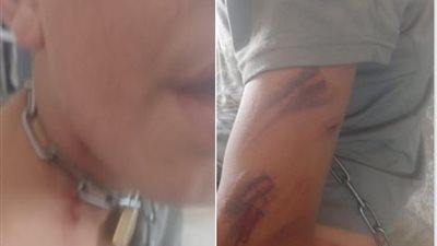 عبدالله، قصة طفل من ذوي الاحتياجات الخاصة تعرض للتعذيب من عمه بوحشية (شاهد بالفيديو)