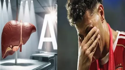 بعد مرض إمام عاشور، ما هو فيروس A وأعرض الإصابة ؟