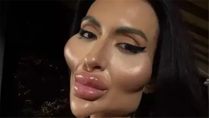 عارضة أزياء تحصل