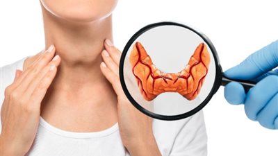  أسباب فرط نشاط الغدة الدرقية عند الرجال والنساء، الهرمونات مصدر إزعاج 
