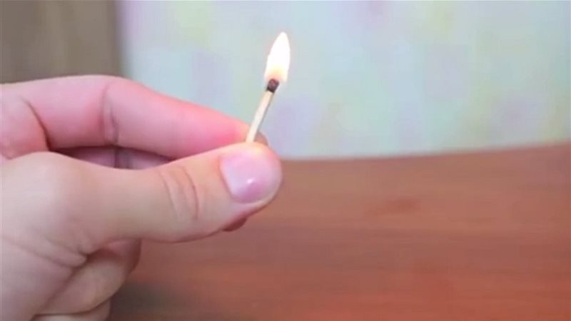 اصابة طالب بحروق
