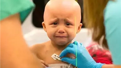 وفقًا لإحصائيات الصحة العالمية، كل 4 دقائق يُصاب 3 أطفال بالسرطان حول العالم