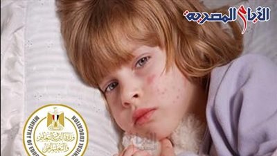 الصحة والتربية والتعليم تطمئنان أولياء الأمور، لا داعي للقلق HFMD .. ليس مرضا خطيرا