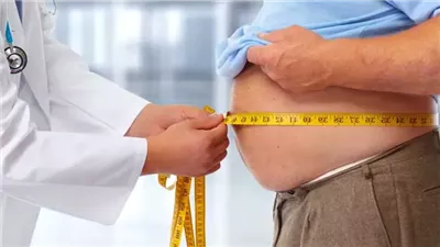 طبيب يكشف أسرع طريقة لحرق دهون البطن الخطيرة بدون رياضة، ما القصة؟