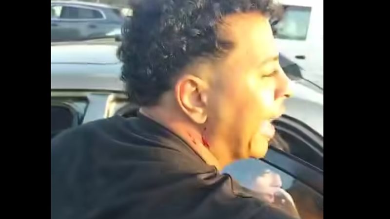 فعل فاضح على المحور