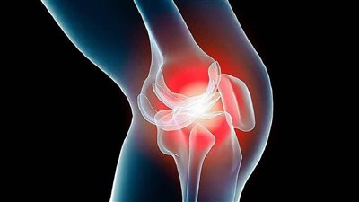 أسباب لا تعرفها عن آلام المفاصل، اكتشف طرق العلاج 