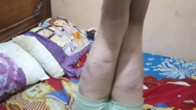 أب يقوم بتعذيب أبنه