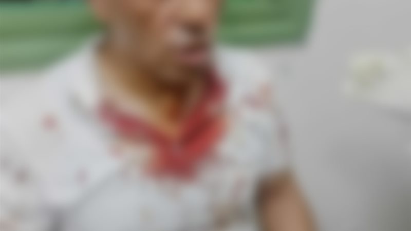 الاعتداء على رجل