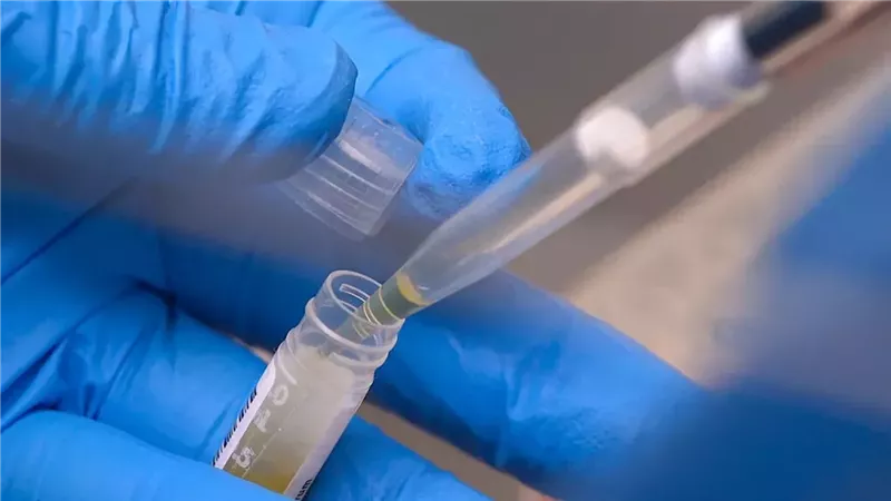 معجزة طبية بريطانية،