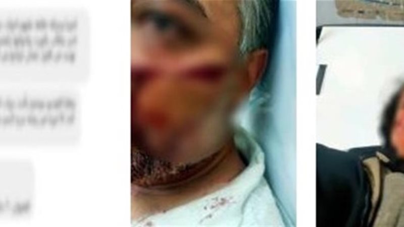 خلاف عائلي يتحول لمشاجرة دامية بالمطرية